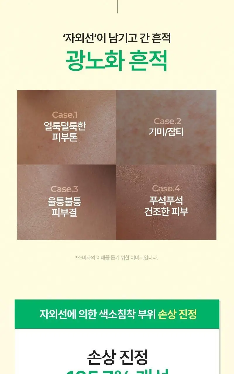 [단독기획] 이지듀 멜라 비 토닝 유브이 선 세럼 40ml 2입 기획 상세페이지 12
